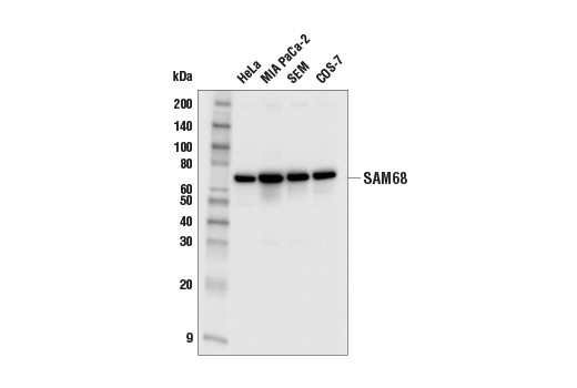 Western Blotting Image 1: SAM68 (E6Y2F) Rabbit mAb