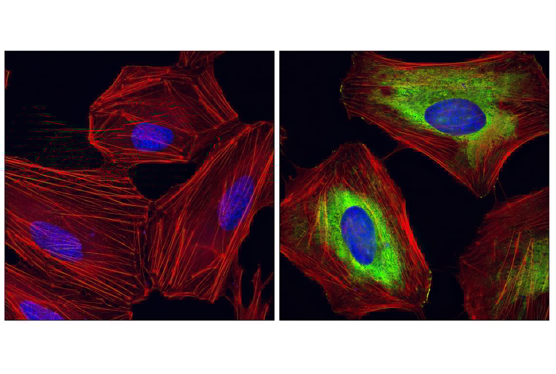 Immunofluorescence Image 1: Phospho-S6 Ribosomal Protein (Ser235/236) (D57.2.2E) Rabbit Monoclonal Antibody (BSA and Azide Free)