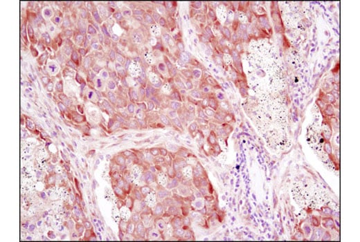 undefined Image 5: PhosphoPlus<sup>®</sup> YB1 (Ser102) Antibody Duet