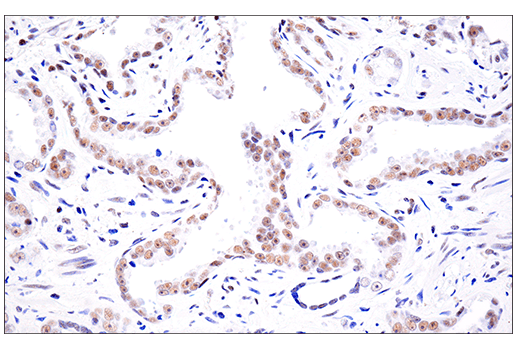 Immunohistochemistry Image 9: SETD2 (E4W8Q) Rabbit Monoclonal Antibody (IHC Formulated)