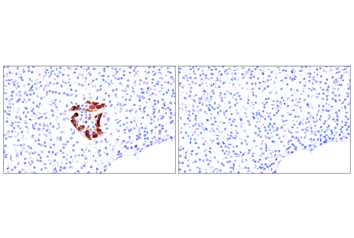 Immunohistochemistry Image 6: FAP (F1A4G) Rabbit Monoclonal Antibody