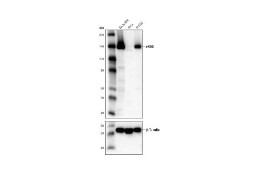 Western Blotting Image 1: eNOS (D8A6N) Rabbit mAb