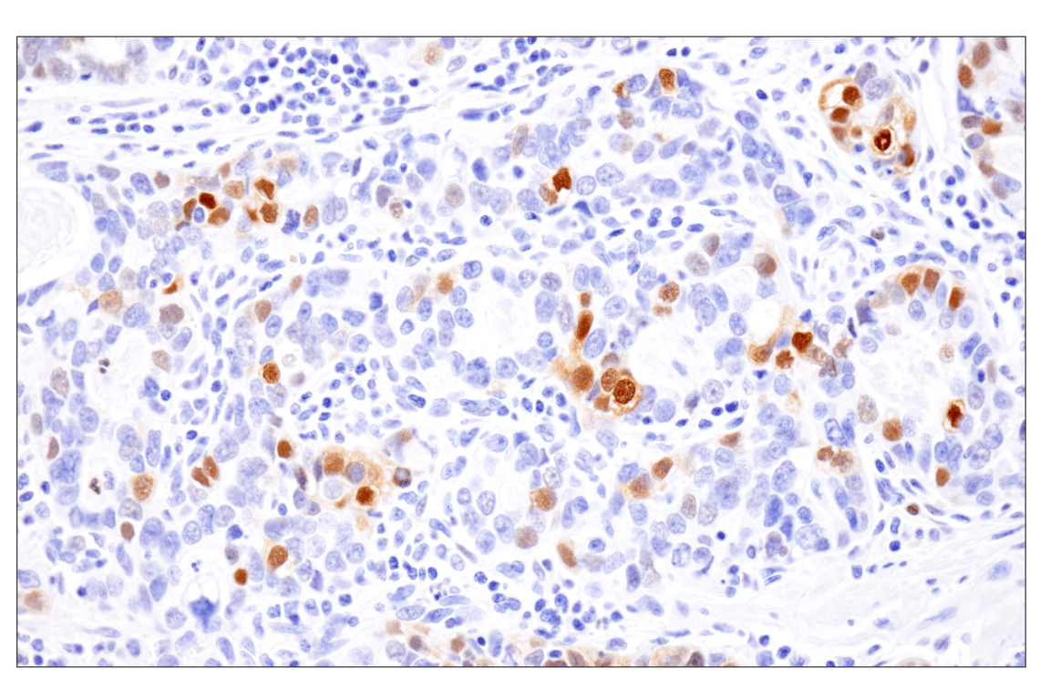 Immunohistochemistry Image 1: Phospho-Stat3 (Ser727) (D4X3C) Rabbit Monoclonal Antibody