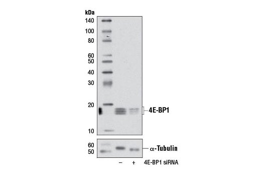 undefined Image 1: SignalSilence<sup>®</sup> 4E-BP1 siRNA I