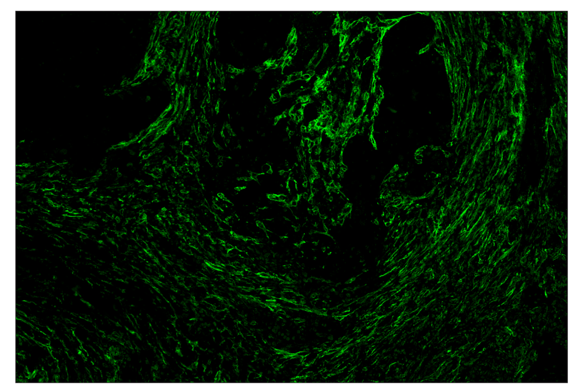 Immunohistochemistry Image 2: FAP (F1A4G) & CO-0116-594 SignalStar<sup>™</sup> Oligo-Antibody Pair
