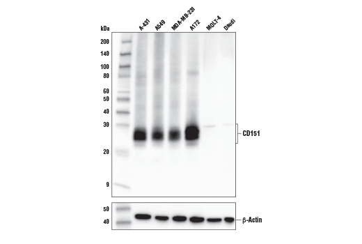 Western Blotting Image 2: CD151 (E9M8T) Rabbit Monoclonal Antibody