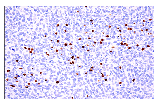 Immunohistochemistry Image 4: S100A8 (E4F8V) Rabbit Monoclonal Antibody (BSA and Azide Free)