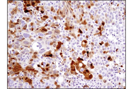 Immunohistochemistry Image 1: SignalStain<sup>®</sup> DAB Substrate Kit