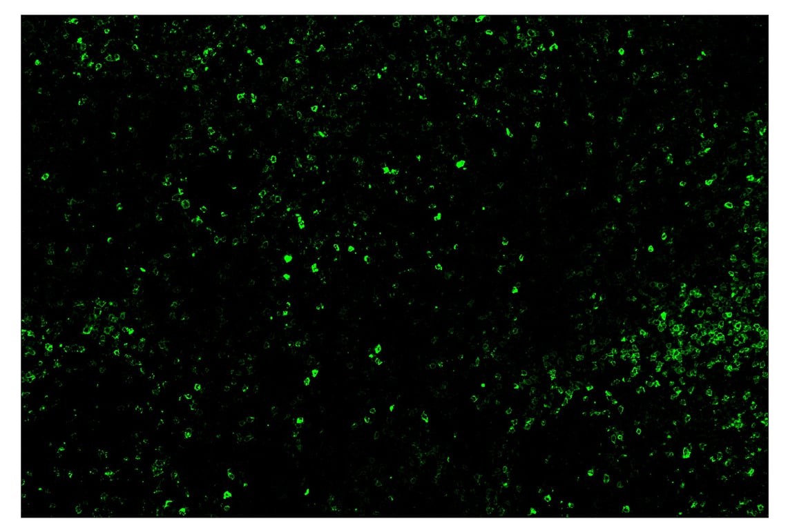 Immunohistochemistry Image 2: LAG3 (D2G4O) & CO-0026-647 SignalStar<sup>®</sup> Oligo-Antibody Pair