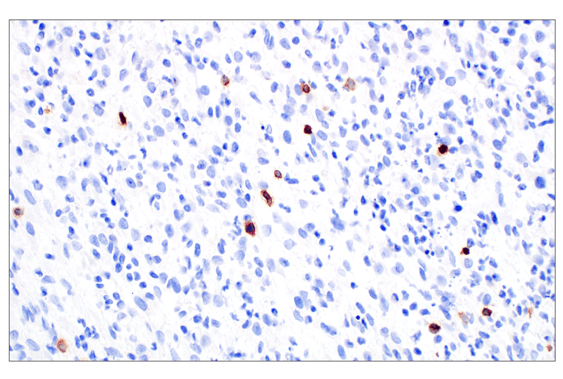Immunohistochemistry Image 2: NCR1/NKp46 (F8M2L) Rabbit Monoclonal Antibody (IHC Formulated)