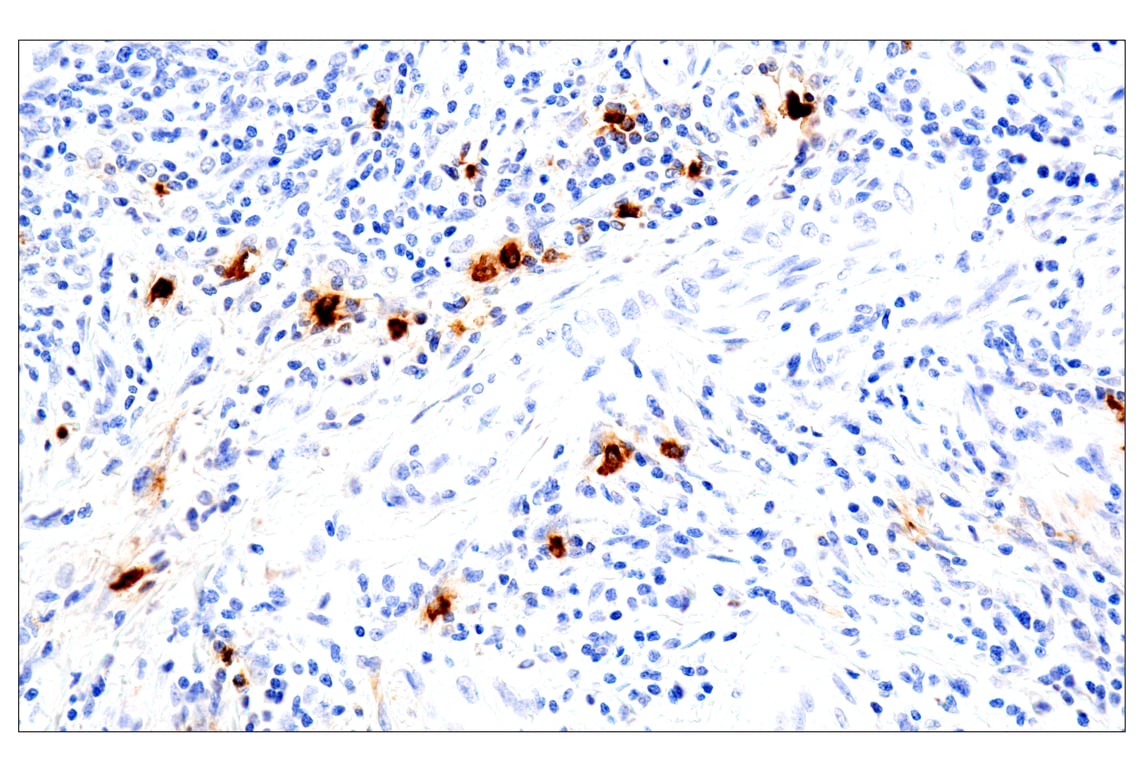 Immunohistochemistry Image 2: Eosinophil cationic protein (E6U5M) Rabbit Monoclonal Antibody (BSA and Azide Free)