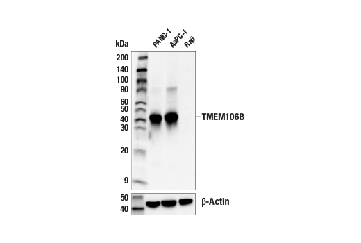 Western Blotting Image 2: TMEM106B (E7H7Z) Rabbit Monoclonal Antibody