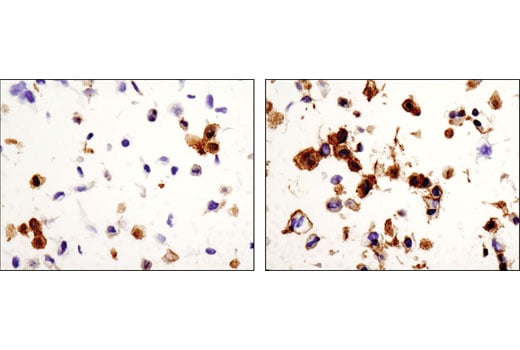 Immunohistochemistry Image 3: Phospho-EphA2 (Ser897) (D9A1) Rabbit Monoclonal Antibody