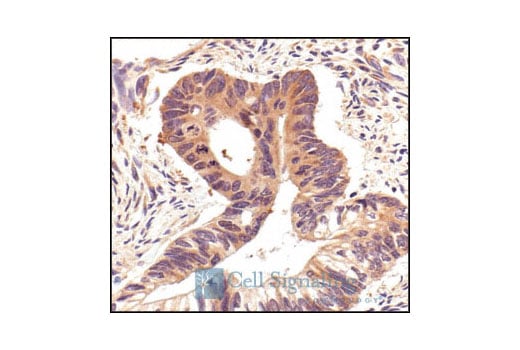 undefined Image 22: HSP/Chaperone Antibody Sampler Kit
