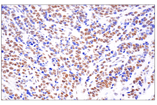 Immunohistochemistry Image 3: SETD2 (E4W8Q) Rabbit Monoclonal Antibody (IHC Formulated)