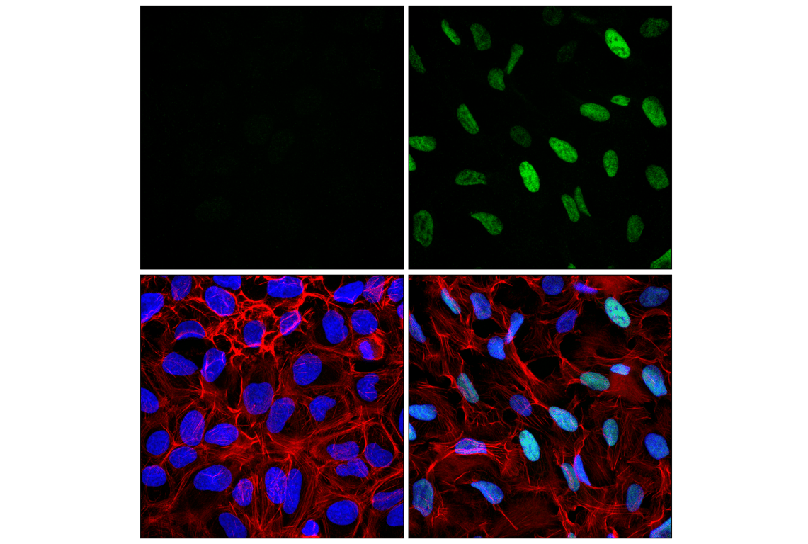 Immunofluorescence Image 1: MDM2 (F7W7X) Rabbit Monoclonal Antibody