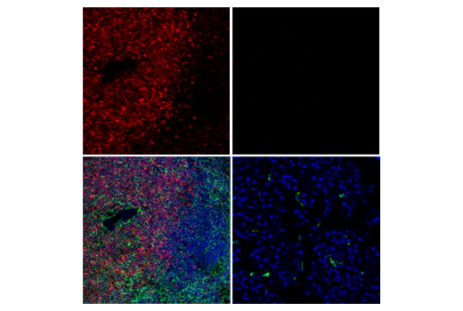 Immunofluorescence Image 1: CD3 epsilon (E4T1B) Rabbit Monoclonal Antibody (BSA and Azide Free)