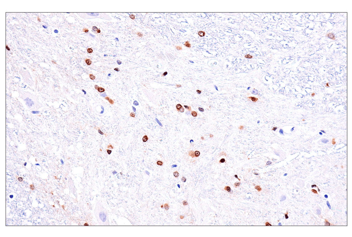 Immunohistochemistry Image 4: Olig1 (E3T6D) Rabbit Monoclonal Antibody