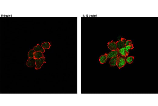 Immunofluorescence Image 1: Phospho-Stat4 (Tyr693) (D2E4) Rabbit Monoclonal Antibody