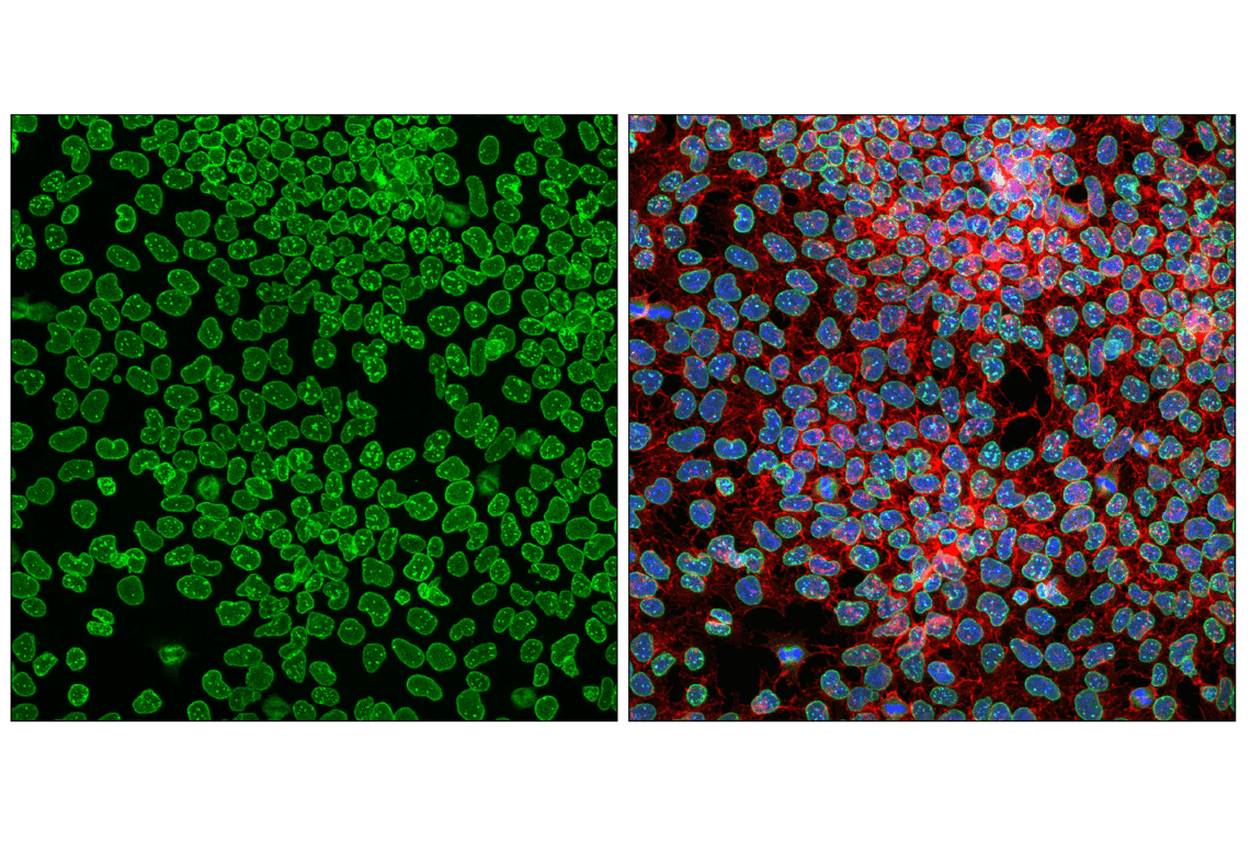 Immunofluorescence Image 1: NUP153 (E3N3Y) Rabbit Monoclonal Antibody