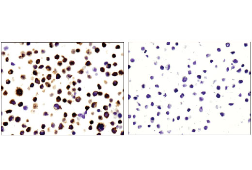 Immunohistochemistry Image 4: PKC theta (E1I7Y) Rabbit Monoclonal Antibody