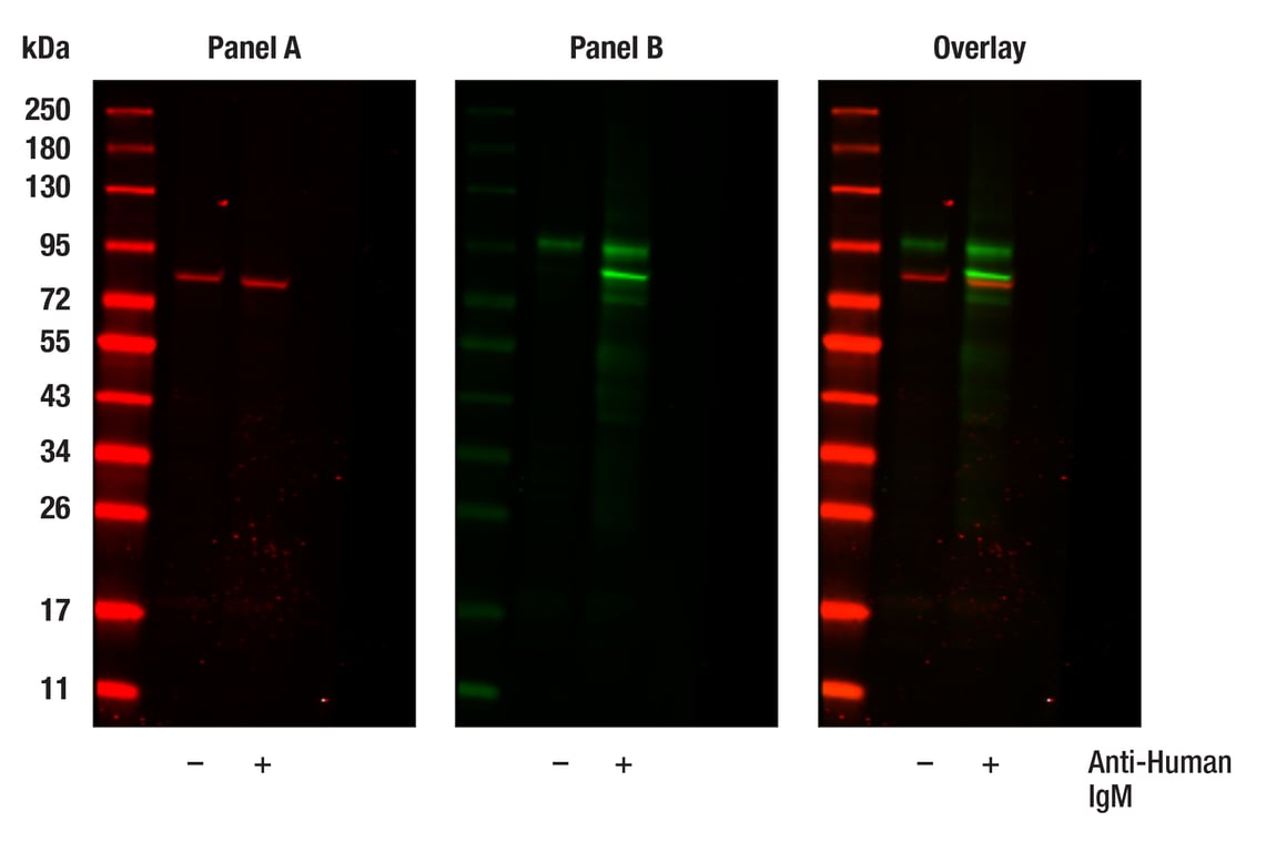 Western Blotting Image 1: Phospho-Btk (Tyr551) (E5Y6N) Rabbit Monoclonal Antibody