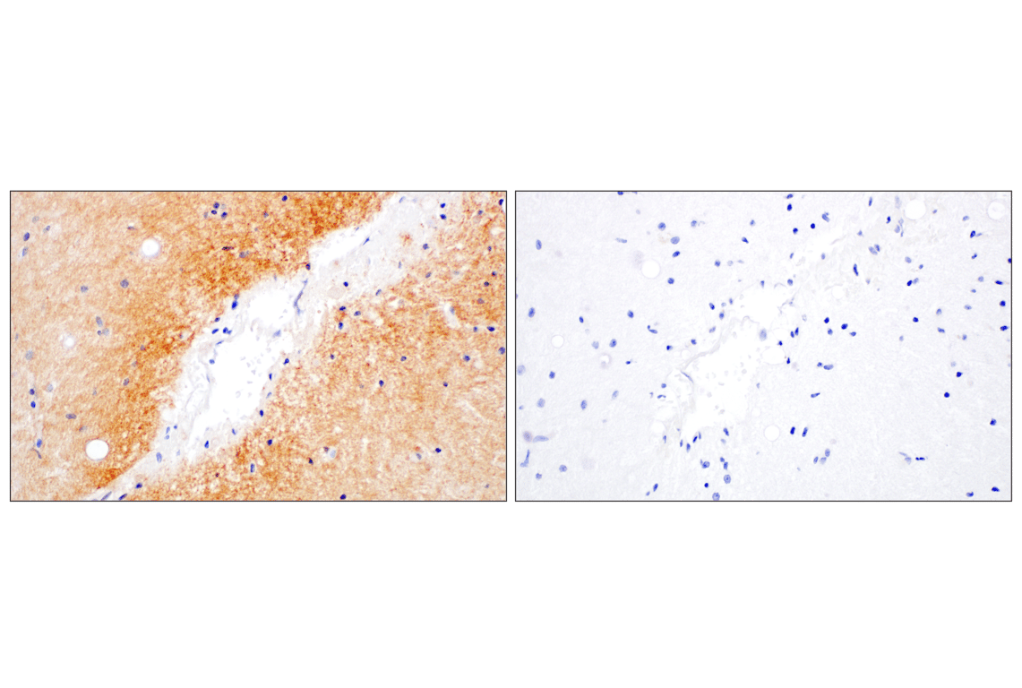 Immunohistochemistry Image 4: Phospho-alpha-Synuclein (Ser129) (D1R1R) Rabbit Monoclonal Antibody