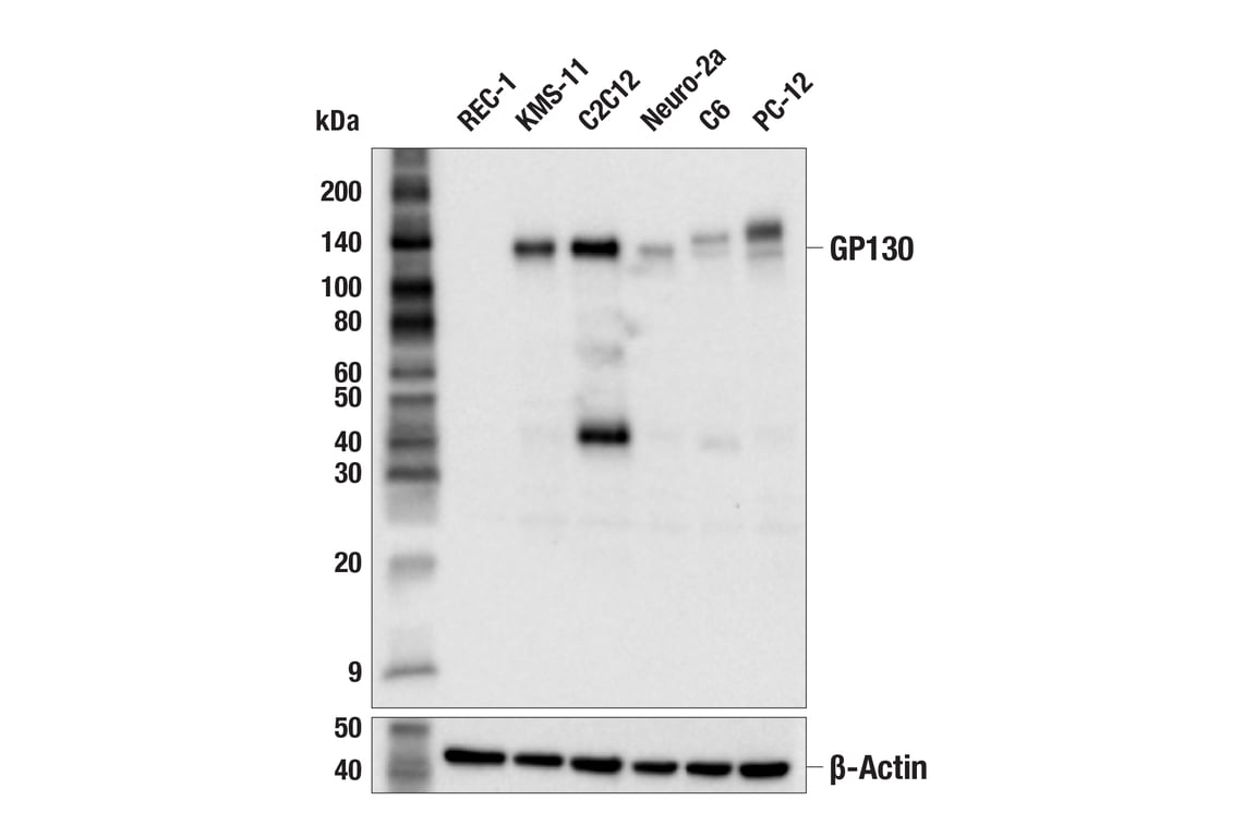Western Blotting Image 2: GP130 (E1D7K) Rabbit Monoclonal Antibody