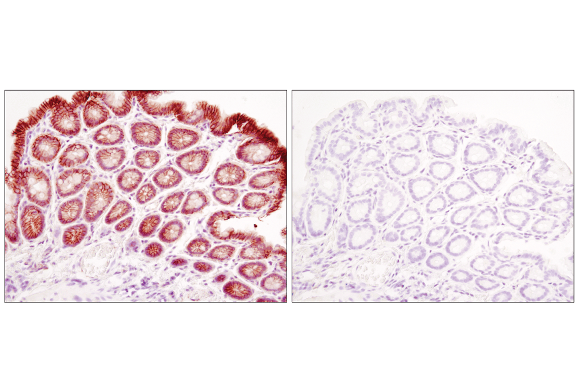 Immunohistochemistry Image 6: beta-Catenin (D10A8) Rabbit Monoclonal Antibody
