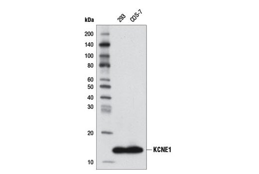 Western Blotting Image 1: KCNE1 (D2D5) Rabbit mAb