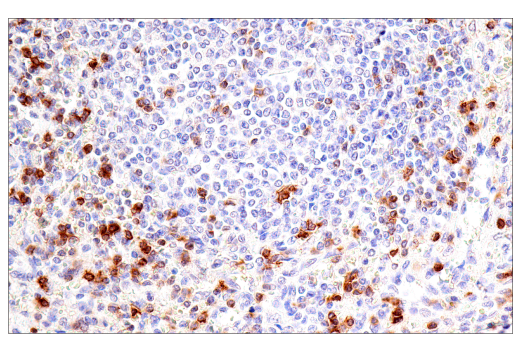Immunohistochemistry Image 4: CD7 (LP15) Mouse mAb