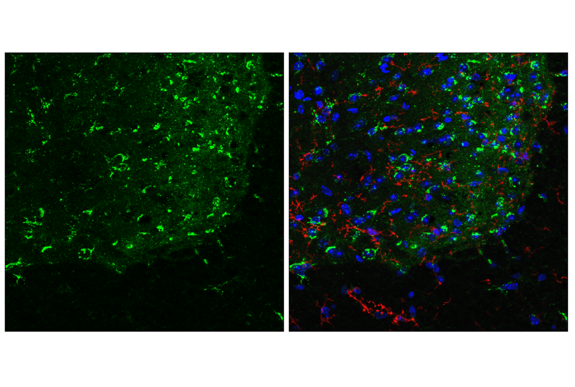 Immunofluorescence Image 2: ITM2C/Bri3 (F3X8Z) Rabbit Monoclonal Antibody