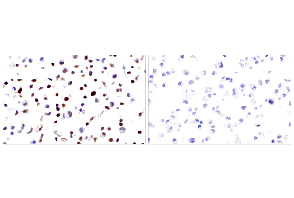 Immunohistochemistry Image 4: WT1 (F3T7B) Rabbit Monoclonal Antibody (Carboxy-terminal Antigen)