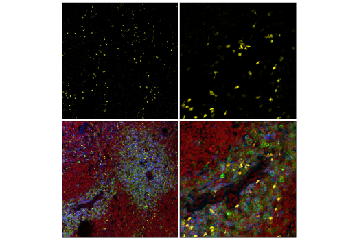 Immunofluorescence Image 1: IRF-8 (E8X4K) Rabbit mAb