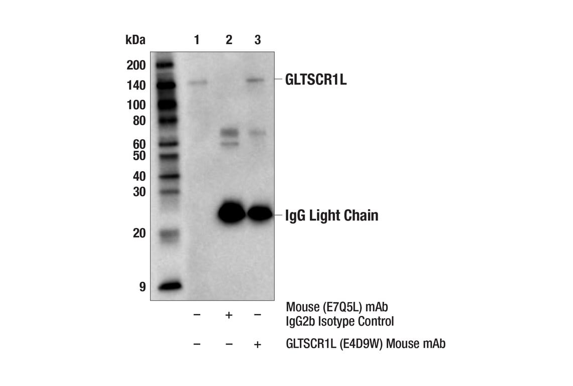 Immunoprecipitation Image 1: GLTSCR1L (E4D9W) Mouse Monoclonal Antibody