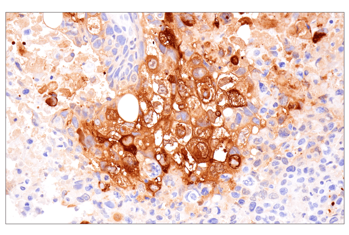 Immunohistochemistry Image 2: Involucrin (F9C3C) Rabbit Monoclonal Antibody