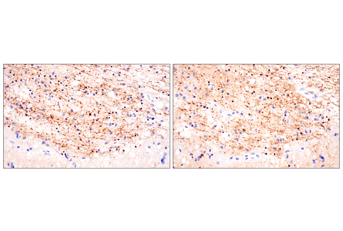 Immunohistochemistry Image 2: Phospho-Tau (Ser396) (F3S9T) Rabbit Monoclonal Antibody