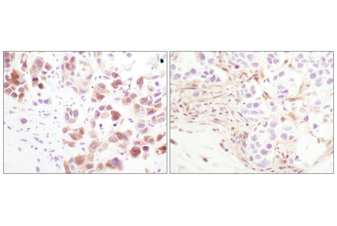 Immunohistochemistry Image 4: Phospho-Akt (Ser473) (D9E) Rabbit Monoclonal Antibody (BSA and Azide Free)