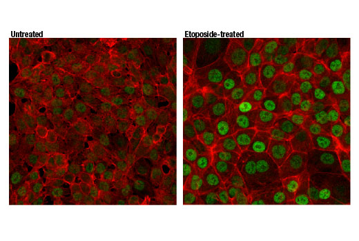 Immunofluorescence Image 1: p73 (D3G10) Rabbit Monoclonal Antibody