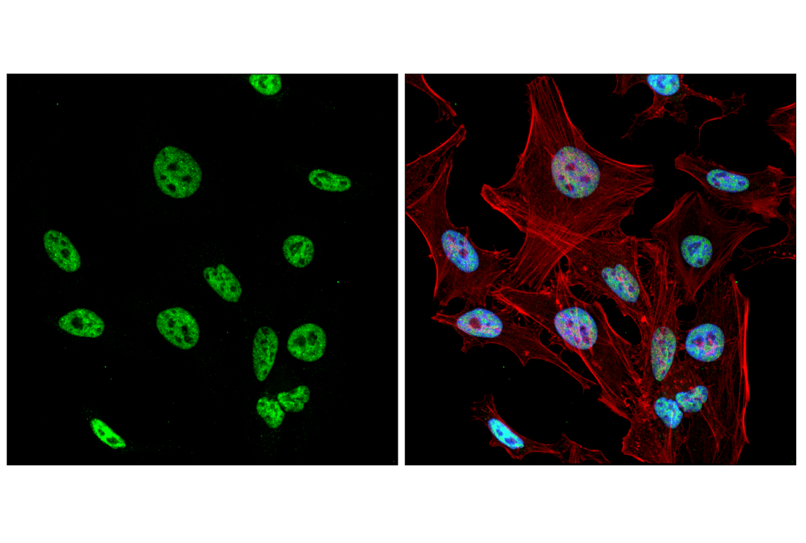 Immunofluorescence Image 2: Rpb1 NTD (D8L4Y) Rabbit Monoclonal Antibody