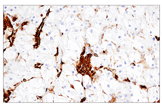 Immunohistochemistry Image 4: CD38 (E7Z8C) Rabbit Monoclonal Antibody