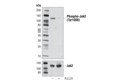 Western Blotting Image 2: Phospho-Jak2 (Tyr1008) (D4A8) Rabbit Monoclonal Antibody