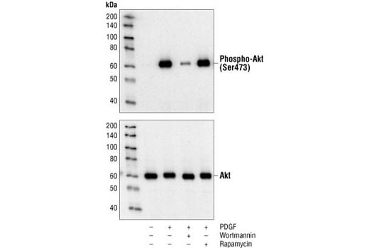 Western Blotting Image 1: Phospho-Akt (Ser473) (193H12) Rabbit mAb