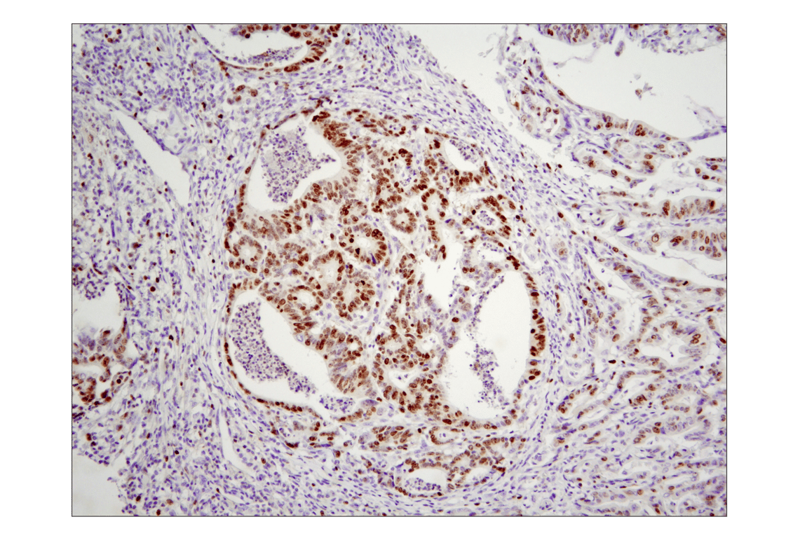 Immunohistochemistry Image 2: Ki-67 (8D5) Mouse Monoclonal Antibody