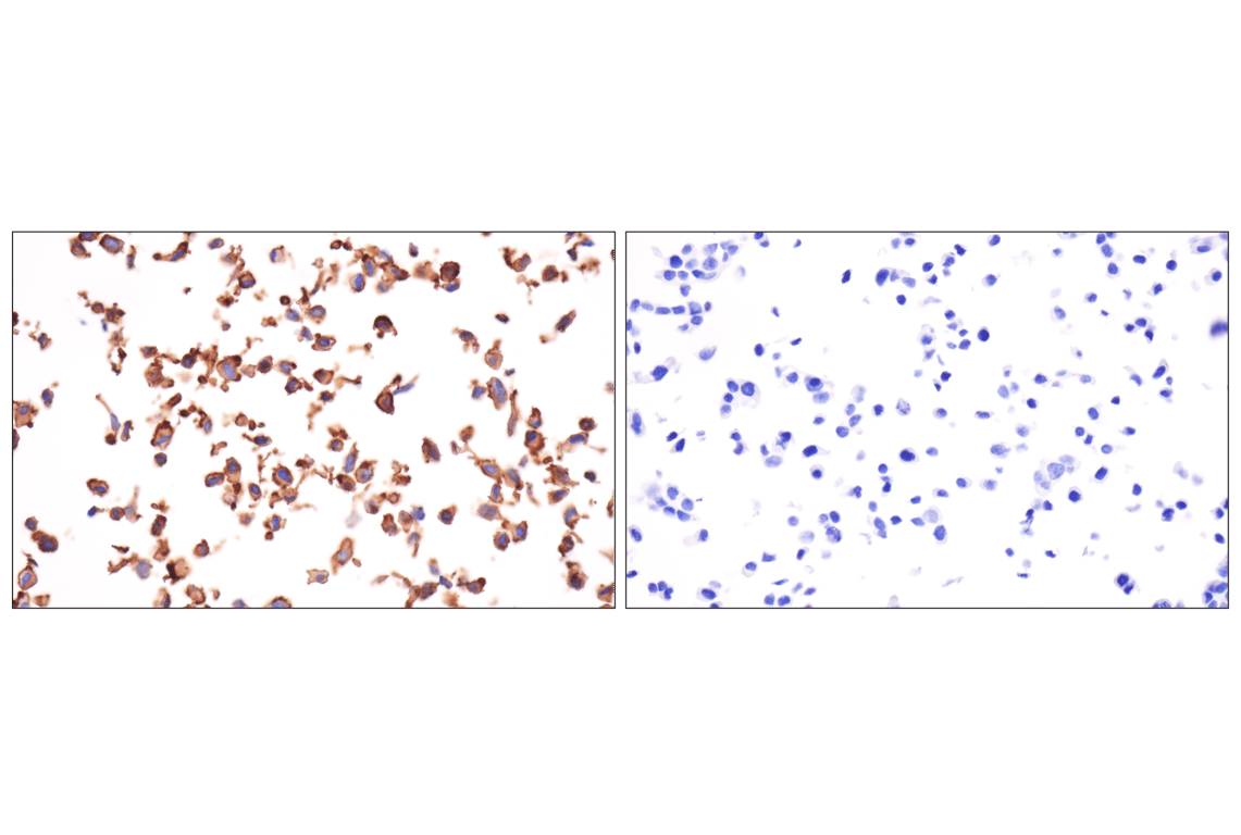 Immunohistochemistry Image 10: N-Cadherin (13A9) Mouse Monoclonal Antibody