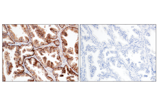Immunohistochemistry Image 4: CD47 (D3O7P) Rabbit Monoclonal Antibody (BSA and Azide Free)