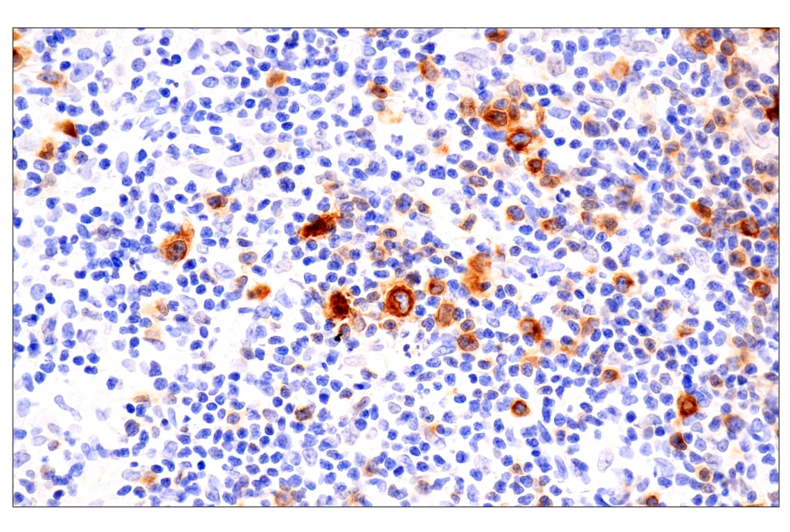 Immunohistochemistry Image 1: TNFRSF8/CD30 (E4L4I) Rabbit Monoclonal Antibody (BSA and Azide Free)