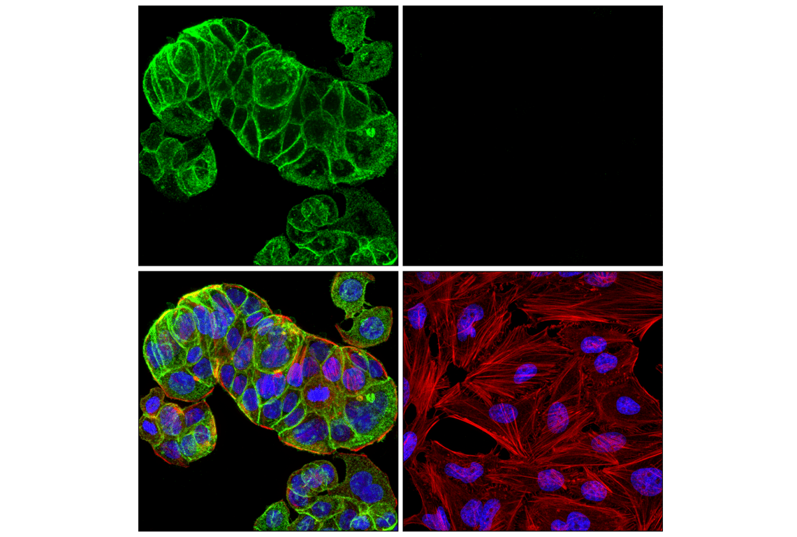 Immunofluorescence Image 1: EpCAM (E6V8Y) Rabbit Monoclonal Antibody