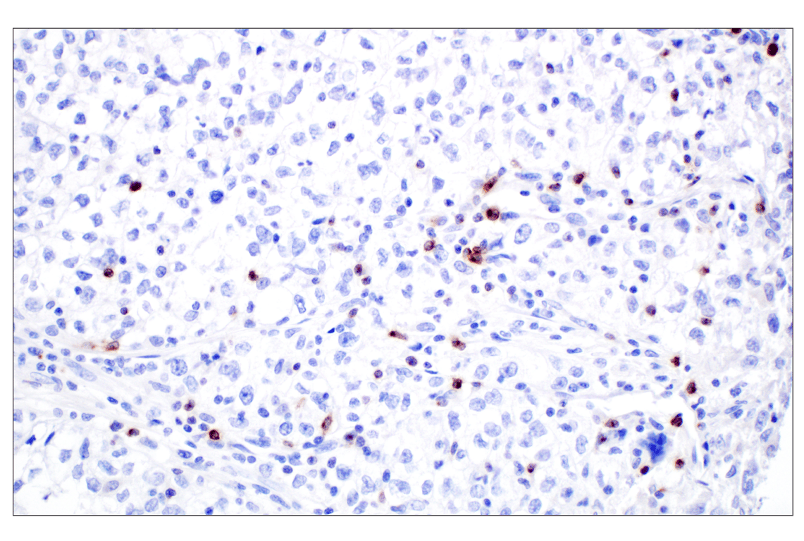 Immunohistochemistry Image 1: CXCL13 (F6A4R) Rabbit Monoclonal Antibody