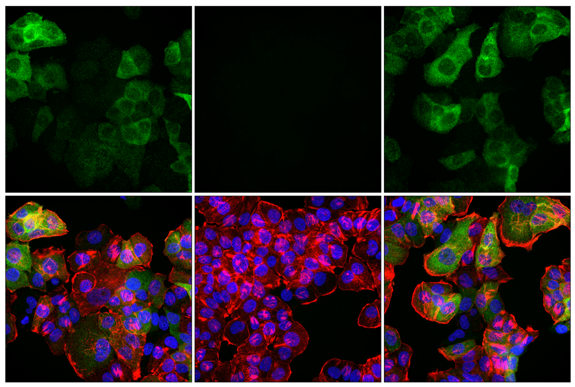 Immunofluorescence Image 2: Phospho-Tau (Ser202) (F2A2F) Rabbit Monoclonal Antibody